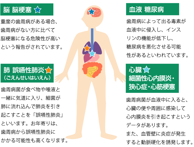 歯周病が原因で引き起こしてしまう病例