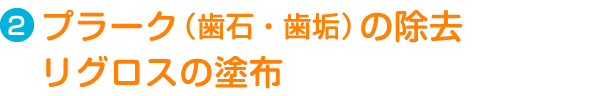 Step2.プラークの除去・リグロスの塗布